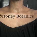 Honey Botanics - Body Hyperpigmentation